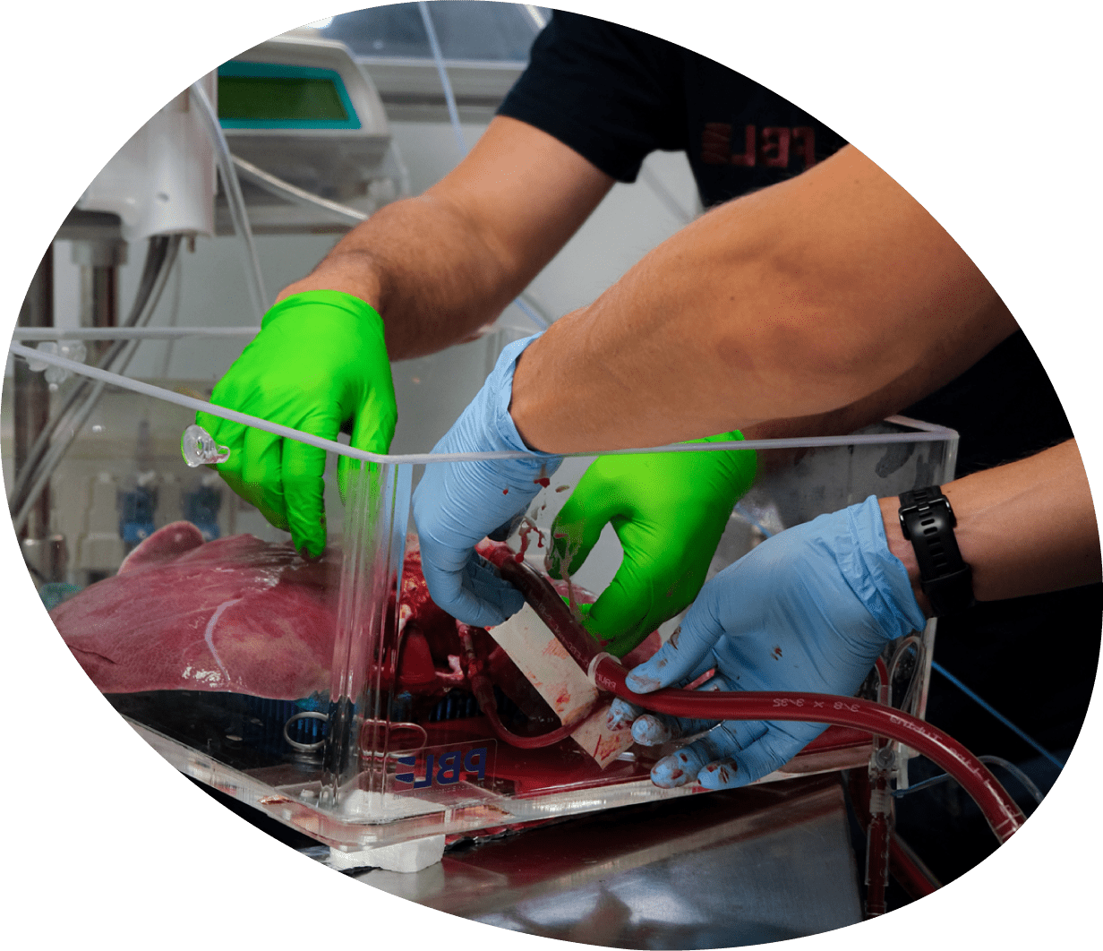 novel ex-vivo organ and tissue perfusion systems