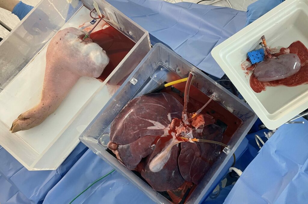 Quadruple Organ perfusion to test for off target effects
